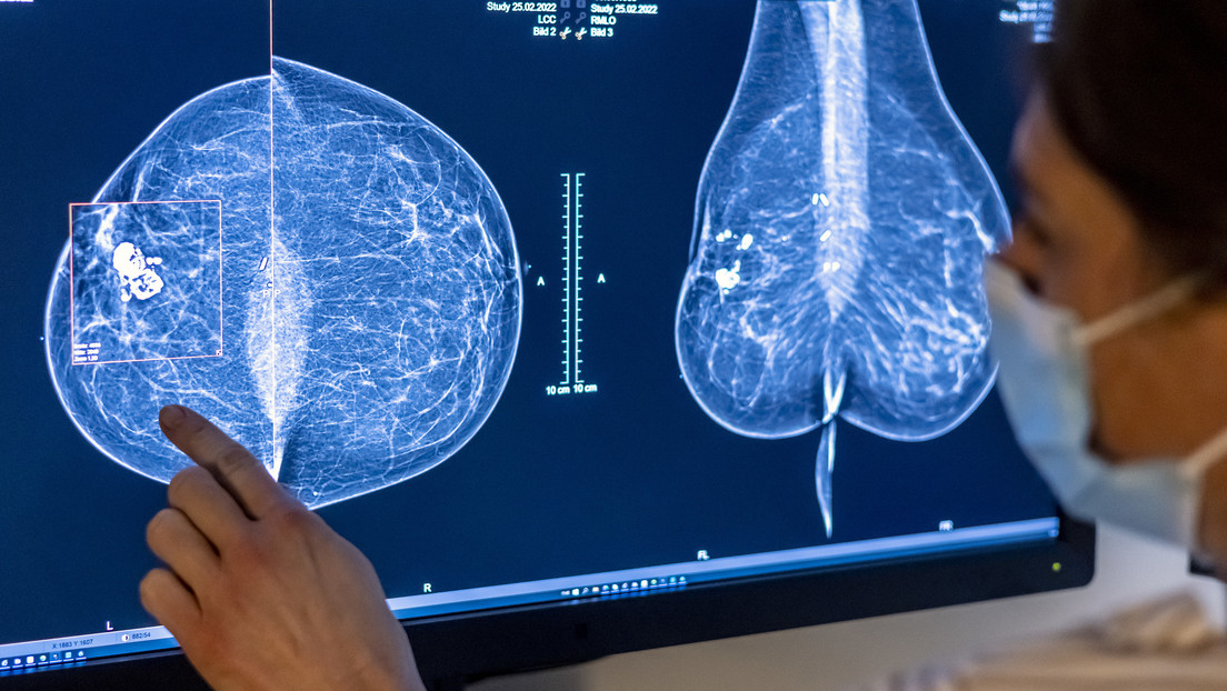 Los sujetadores del futuro detectarán el cáncer de mama
