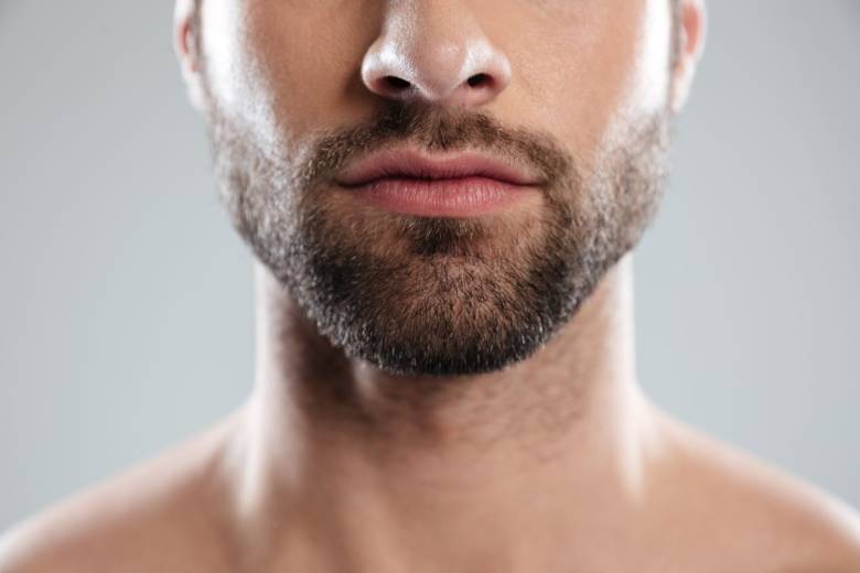 trasplante de barba