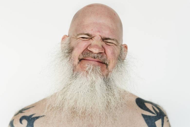 alopecia y barba
