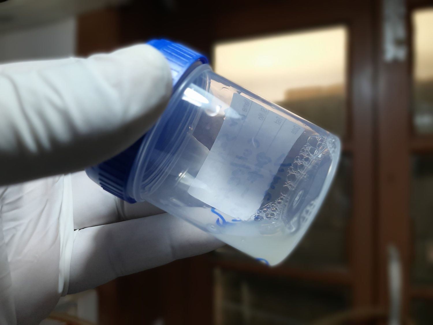 concentración de espermatozoides, olor semen