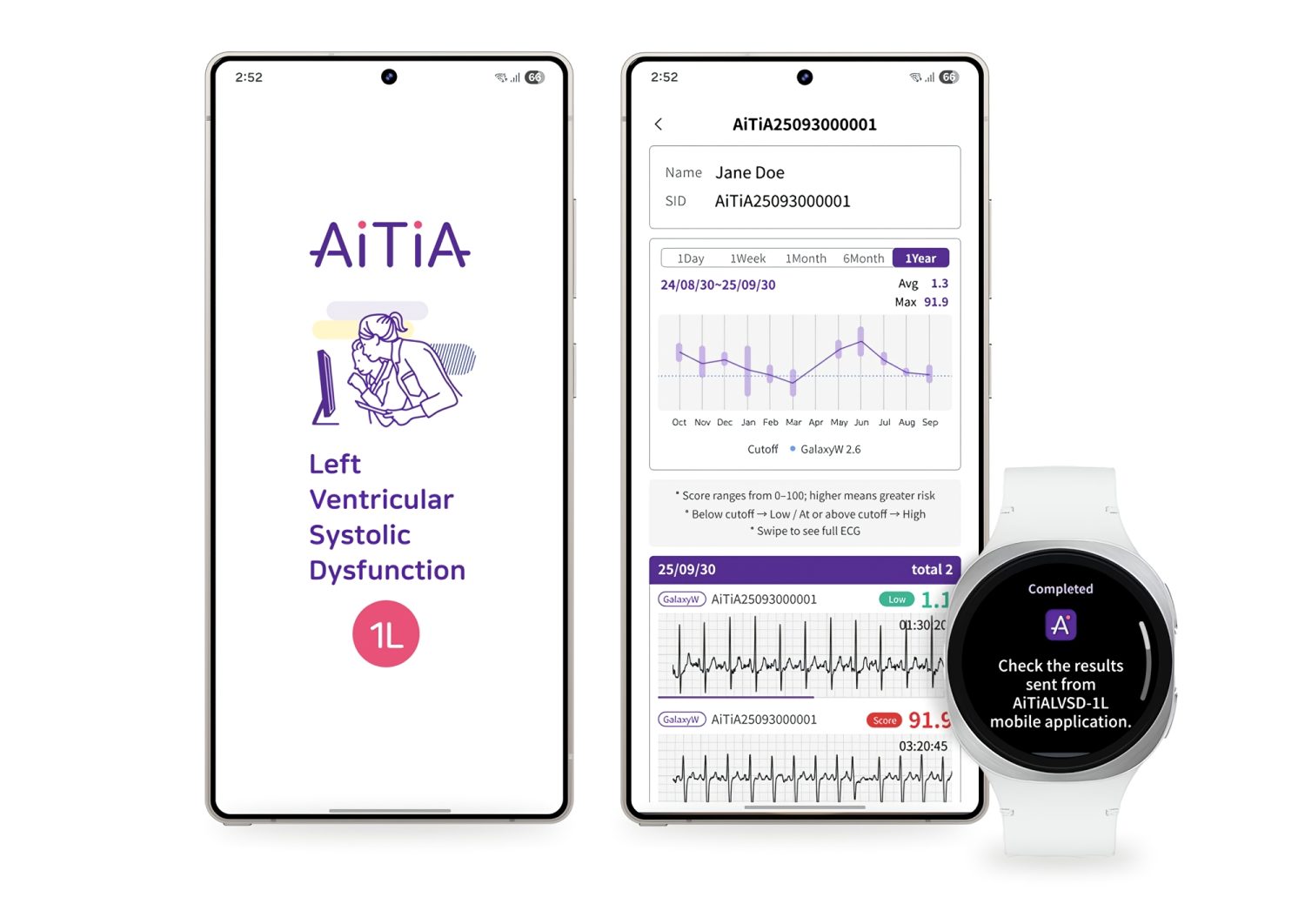 Los Galaxy Watch de Samsung podrán detectar la disfunción ventricular sistólica